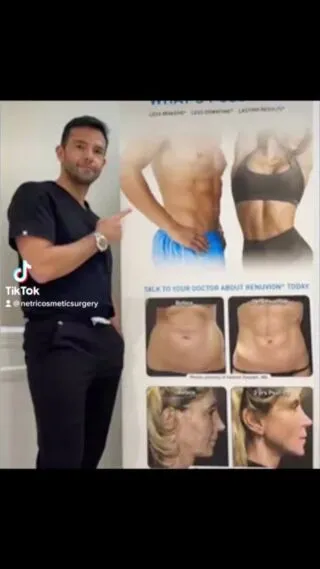 #renuvion #renuvionjplasma #liposuction #liposculpture #vaser #vaserliposuction #vaserlipo