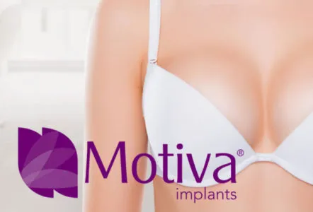 motiva implant cheshire